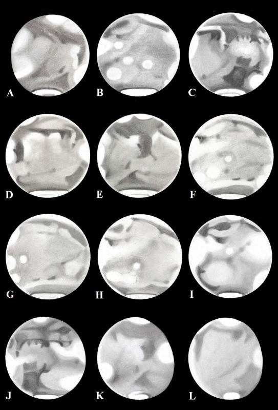 Figure 1. A selection of Richard McKim's drawings of Mars around its 2010 opposition.