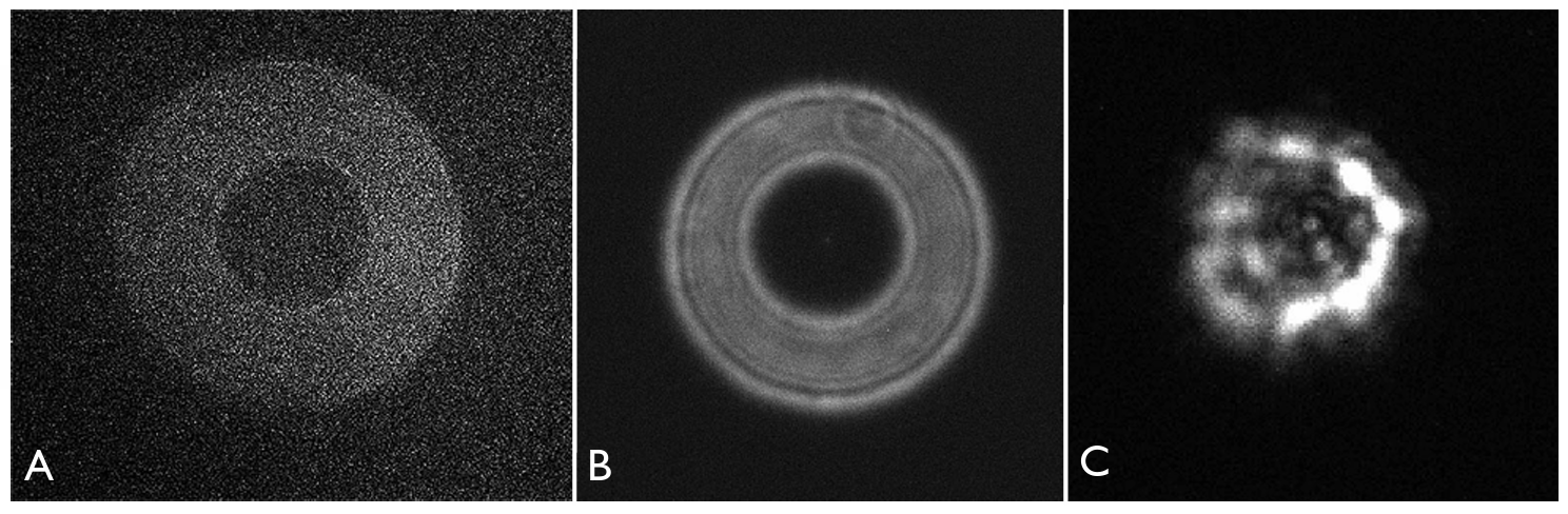 Three black-and-white images of the out-of-focus star against a black sky. In A, the star appears as a faint doughnut. In B, it is a slightly less diffuse donut, with brighter edges. In C, it is a much less regular donut; a non-symmetrical ring of light blobs